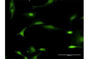 Immunofluorescence of purified MaxPab antibody to FANCL on HeLa cell. (FANCL 抗体  (AA 1-375))