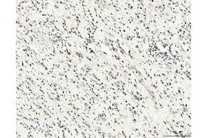 IHC analysis of RRP4/EXOSC2 using anti-RRP4/EXOSC2 antibody (ABIN7602188). (EXOSC2 抗体  (AA 62-293))