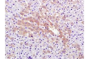 Paraformaldehyde-fixed, paraffin embedded Rat liver; Antigen retrieval by boiling in sodium citrate buffer (pH6. (RNF213 抗体  (AA 4750-4800))