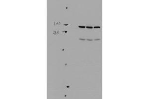 Western blot analysis of Mouse kidney tissue lysates showing detection of ENaC protein using Rabbit Anti-ENaC Polyclonal Antibody . (SCNN1A 抗体  (AA 46-68) (PerCP))