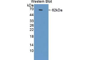 Western blot analysis of the recombinant protein. (GRIA2 抗体  (AA 25-543))