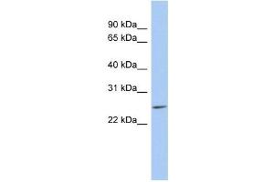 LYPD5 antibody used at 1 ug/ml to detect target protein. (LYPD5 抗体  (N-Term))