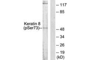 Western blot analysis of extracts from 293 cells treated with Etoposide 25uM 60', using Keratin 8 (Phospho-Ser73) Antibody.