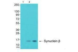 Western blot analysis of extracts from 293 cells (Lane 2) and cos-7 cells (Lane 3), using Synuclein β antiobdy. (beta Synuclein 抗体)