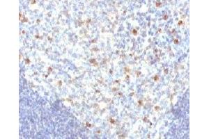 IHC analysis of FFPE human tonsil tissue and IgM antibody (MuHC2) (小鼠 anti-人 IgM Antibody)