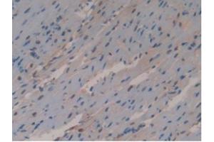 Detection of GSTo1 in Mouse Heart Tissue using Polyclonal Antibody to Glutathione S Transferase Omega 1 (GSTo1) (GSTO1 抗体  (AA 24-233))