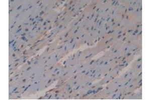 Detection of GSTo1 in Mouse Heart Tissue using Polyclonal Antibody to Glutathione S Transferase Omega 1 (GSTo1) (GSTO1 抗体  (AA 24-233))