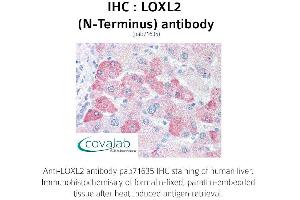 Image no. 1 for anti-Lysyl Oxidase-Like 2 (LOXL2) (N-Term) antibody (ABIN1736517) (LOXL2 抗体  (N-Term))