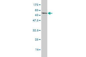 Western Blot detection against Immunogen (70. (PHKG2 抗体  (AA 1-406))