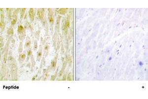 Immunohistochemistry analysis of paraffin-embedded human heart tissue using GTF2E2 polyclonal antibody . (GTF2E2 抗体)