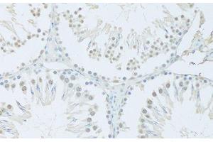 Immunohistochemistry of paraffin-embedded Rat testis using FIP1L1 Polyclonal Antibody at dilution of 1:100 (20x lens). (FIP1L1 抗体)