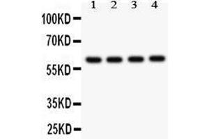 Observed bind size: 60KD (CADM1 抗体  (AA 45-340))