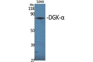 Western Blot (WB) analysis of specific cells using DGK-alpha Polyclonal Antibody. (DGKA 抗体  (Internal Region))