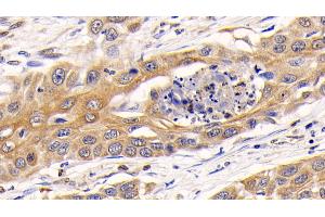 Immunohistochemistry (IHC) image for anti-Cathepsin K (CTSK) (AA 71-319) antibody (ABIN7431476)