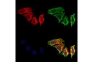 ABIN6265660 and ABIN6279885 staining Hela cells by IF/ICC. (TNNT1 抗体  (N-Term))