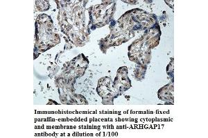 Image no. 1 for anti-rho GTPase Activating Protein 17 (ARHGAP17) antibody (ABIN1574792) (ARHGAP17 抗体)