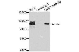 Immunoprecipitation analysis of 200ug extracts of 293T cells using 1ug EIF4B antibody. (EIF4B 抗体)