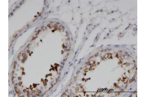 Immunoperoxidase of monoclonal antibody to GKAP1 on formalin-fixed paraffin-embedded human testis. (GKAP1 抗体  (AA 1-366))