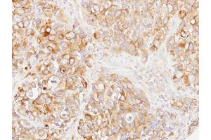 IHC-P Image Immunohistochemical analysis of paraffin-embedded H661 xenograft, using DOK1, antibody at 1:500 dilution. (DOK1 抗体)