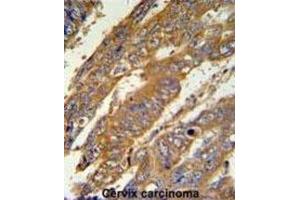 Immunohistochemistry (IHC) image for anti-PAN3 Poly(A) Specific Ribonuclease Subunit Homolog (PAN3) antibody (ABIN3002182) (PAN3 抗体)