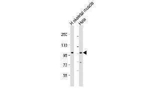 All lanes : Anti-ATXN2 Antibody (Center) at 1:2000 dilution Lane 1: human skeletal muscle lysate Lane 2: Hela whole cell lysate Lysates/proteins at 20 μg per lane. (Ataxin 2 抗体  (AA 725-757))