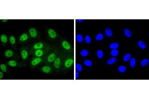 HepG2 cells were stained with SIRT1(T530) (6H5) Monoclonal Antibody  at [1:200] incubated overnight at 4C, followed by secondary antibody incubation, DAPI staining of the nuclei and detection. (SIRT1 抗体  (pThr530))