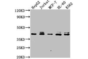 Western Blot Positive WB detected in: HepG2 whole cell lysate, Jurkat whole cell lysate, MCF-7 whole cell lysate, HL-60 whole cell lysate, K562 whole cell lysate All lanes: LSM11 antibody at 1:2000 Secondary Goat polyclonal to rabbit IgG at 1/50000 dilution Predicted band size: 40 kDa Observed band size: 40 kDa (LSM11 抗体  (AA 1-141))