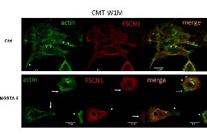 Representative confocal microscopy images of cytoskeletal protein F-actin and fascin 1 in CMT-W1M canine carcinoma cell line. (Fascin 抗体  (pSer39))