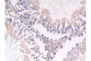 Immunohistochemistry (IHC) image for anti-Fibrinogen-Like 1 (FGL1) (AA 23-314) antibody (ABIN7438670)