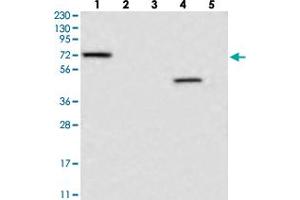 Western blot analysis of Lane 1: RT-4, Lane 2: U-251 MG, Lane 3: Human Plasma, Lane 4: Liver, Lane 5: Tonsil with LRRC40 polyclonal antibody  at 1:250-1:500 dilution. (LRRC40 抗体)