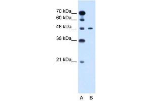 WB Suggested Anti-PBX1 Antibody Titration: 0. (PBX1 抗体  (N-Term))