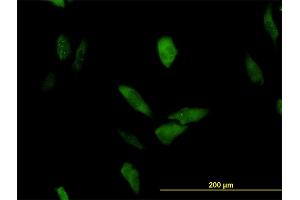 Immunofluorescence of monoclonal antibody to LRRFIP1 on HeLa cell.