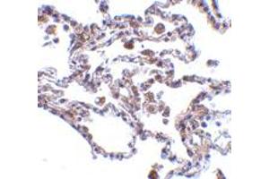 Immunohistochemistry of TRAF3IP2 in human lung tissue with TRAF3IP2 polyclonal antibody  at 5 ug/mL .