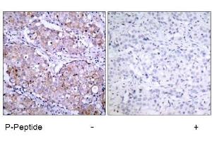 Image no. 1 for anti-Epidermal Growth Factor Receptor (EGFR) (pSer1070) antibody (ABIN196758) (EGFR 抗体  (pSer1070))