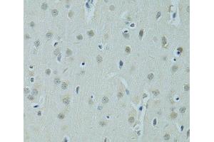 Immunohistochemistry of paraffin-embedded Rat brain using ZNF346 Polyclonal Antibody at dilution of 1:100 (40x lens). (ZNF346 抗体)