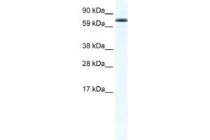 Western Blotting (WB) image for anti-Forkhead Box O6 (Foxo6) antibody (ABIN2461559) (Foxo6 抗体)