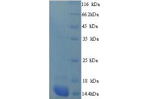 SDS-PAGE (SDS) image for S100 Calcium Binding Protein A7A (S100A7A) (AA 2-101) protein (His tag) (ABIN5714410)