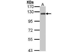 Western Blotting (WB) image for anti-Breast Cancer Anti-Estrogen Resistance 1 (BCAR1) (Internal Region) antibody (ABIN2854807)