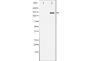 Western blot analysis of Bcr expression in HepG2 whole cell lysates,The lane on the left is treated with the antigen-specific peptide. (BCR 抗体  (Internal Region))