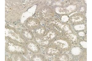 ABIN6256074 and ABIN6267116 at 1/100 staining human normal kidney tissue by IHC-P. (FLT3 抗体  (pTyr969))