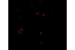 Immunofluorescence of MDA5 in Human Lymph Node cells with MDA5 Antibody  at 20 mg/ml (IFIH1 抗体  (Center))