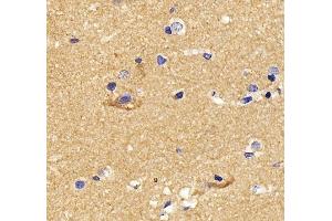 IHC analysis of GNAL using anti-GNAL antibody (ABIN7599757).