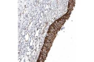 Immunohistochemical staining of human nasopharynx with DNAH1 polyclonal antibody  shows strong cytoplasmic and membranous positivity in respiratory epithelial cells at 1:200-1:500 dilution. (DNAH1 抗体)