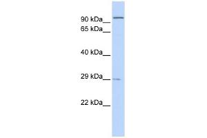 Sarcospan antibody used at 1 ug/ml to detect target protein. (SSPN 抗体)