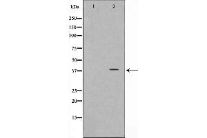 Western blot analysis on LOVO cell lysate using Synaptophysin Antibody,The lane on the left is treated with the antigen-specific peptide. (Synaptophysin 抗体  (Internal Region))