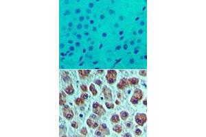 Image no. 1 for anti-Eukaryotic Translation Initiation Factor 4A1 (EIF4A1) (AA 350-400) antibody (ABIN960156) (EIF4A1 抗体  (AA 350-400))