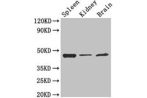 Western Blot Positive WB detected in: Mouse spleen tissue, Mouse kidney tissue, Mouse brain tissue All lanes: LAMP2 antibody at 4 μg/mL Secondary Goat polyclonal to rabbit IgG at 1/50000 dilution Predicted band size: 45, 46 kDa Observed band size: 45 kDa (LAMP2 抗体  (AA 54-268))