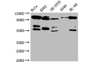 Western Blot Positive WB detected in: Hela whole cell lysate, SH-SY5Y whole cell lysate, K562 whole cell lysate All lanes: OFD1 antibody at 1:2000 Secondary Goat polyclonal to rabbit IgG at 1/50000 dilution Predicted band size: 117, 43, 112 kDa Observed band size: 117 kDa (OFD1 抗体  (AA 598-771))