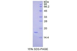 SDS-PAGE (SDS) image for Complexin 2 (CPLX2) (AA 2-134) protein (His tag) (ABIN1877474) (CPLX2 Protein (AA 2-134) (His tag))