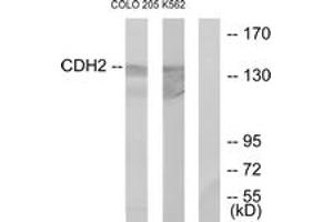 Western blot analysis of extracts from COLO205/K562 cells, using CDH2 Antibody. (N-Cadherin 抗体  (AA 721-770))